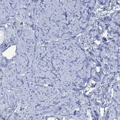 Immunohistochemistry-Paraffin: FBP2 Antibody [NBP3-17033]