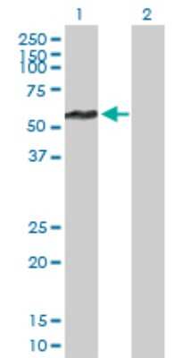 Western Blot: FBXL17 Antibody [H00064839-B01P]
