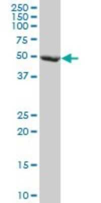 Western Blot: FBXL3 Antibody (1A3) [H00026224-M03]
