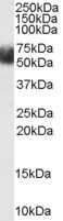 Western Blot: FBXL3 Antibody [NB100-53784]