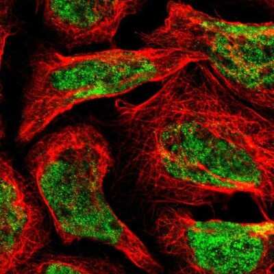 Immunocytochemistry/ Immunofluorescence: FBXL6 Antibody [NBP2-58922]