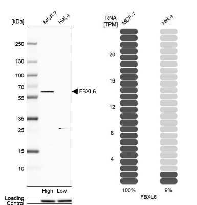 Western Blot: FBXL6 Antibody [NBP2-58922]