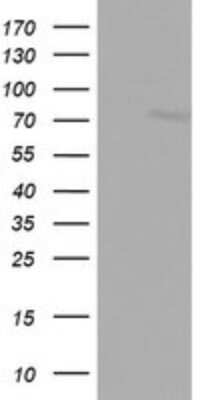 Western Blot: FBXO11 Antibody (OTI1F6) [NBP2-45620]