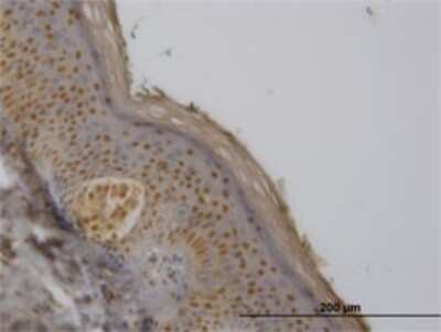 Immunohistochemistry-Paraffin: FBXO11 Antibody (4C12) [H00080204-M01]
