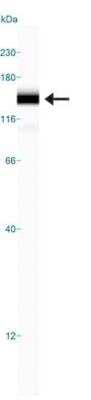 Simple Western: FBXO11 Antibody [NB100-59826]