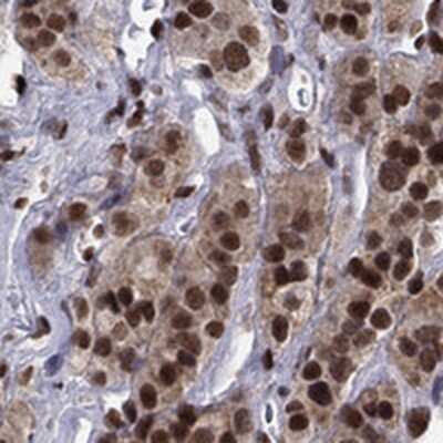 Immunohistochemistry-Paraffin: FBXO16 Antibody [NBP3-17846]