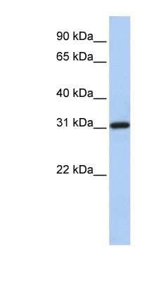Western Blot: FBXO16 Antibody [NBP1-57614]