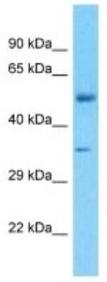 Western Blot: FBXO2 Antibody [NBP3-10565]