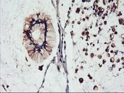 Immunohistochemistry-Paraffin: FBXO21 Antibody (OTI2C7) [NBP2-01569]