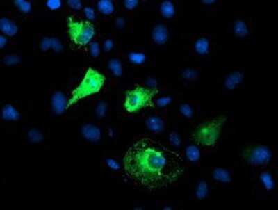 Immunocytochemistry/ Immunofluorescence: FBXO21 Antibody (OTI2C7) - Azide and BSA Free [NBP2-71711]