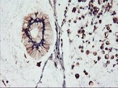 Immunohistochemistry: FBXO21 Antibody (OTI2C7) - Azide and BSA Free [NBP2-71711]