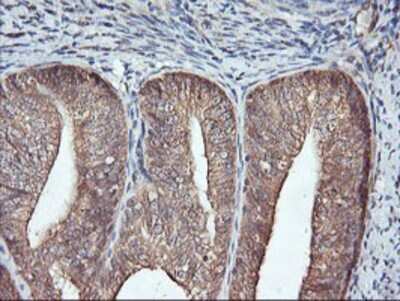 Immunohistochemistry: FBXO21 Antibody (OTI2C7) - Azide and BSA Free [NBP2-71711]