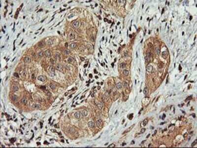 Immunohistochemistry: FBXO21 Antibody (OTI2C7) - Azide and BSA Free [NBP2-71711]