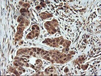 Immunohistochemistry: FBXO21 Antibody (OTI2C7) - Azide and BSA Free [NBP2-71711]