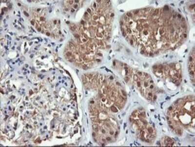 Immunohistochemistry: FBXO21 Antibody (OTI2C7) - Azide and BSA Free [NBP2-71711]