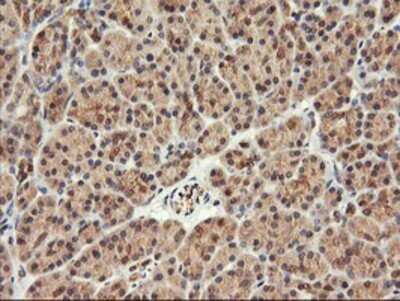 Immunohistochemistry: FBXO21 Antibody (OTI2C7) - Azide and BSA Free [NBP2-71711]