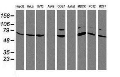 Western Blot: FBXO21 Antibody (OTI2C7)Azide and BSA Free [NBP2-71711]