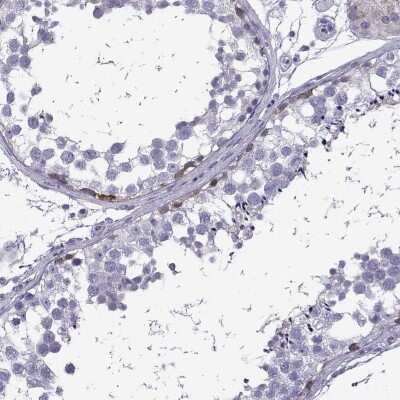 Immunohistochemistry-Paraffin: FBXO24 Antibody [NBP2-47457]