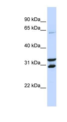 Western Blot: FBXO24 Antibody [NBP1-53140]