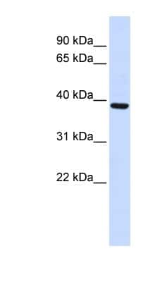 Western Blot: FBXO24 Antibody [NBP1-53141]