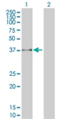 Western Blot: FBXO25 Antibody (2F1) [H00026260-M01]