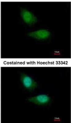 Immunocytochemistry/ Immunofluorescence: FBXO28 Antibody [NBP2-16448]