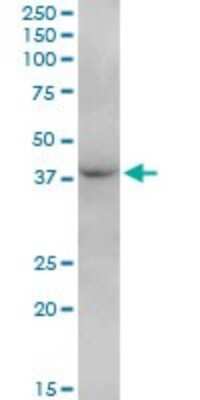 Western Blot: FBXO28 Antibody [H00023219-B01P]
