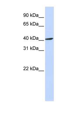 Western Blot: FBXO28 Antibody [NBP1-55341]