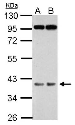 Western Blot: FBXO28 Antibody [NBP2-16448]