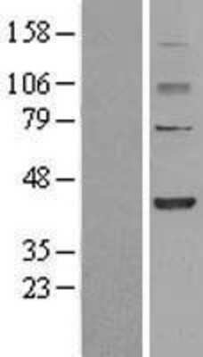 Western Blot: FBXO28 Overexpression Lysate [NBL1-10628]