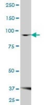 Western Blot: FBXO30 Antibody [H00084085-B01P]