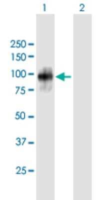 Western Blot: FBXO30 Antibody [H00084085-B01P]
