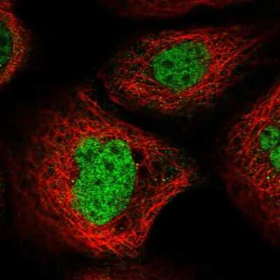 Immunocytochemistry/ Immunofluorescence: FBXO33 Antibody [NBP1-91890]