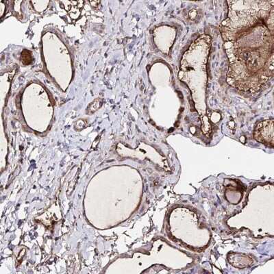 Immunohistochemistry: FBXO34 Antibody [NBP2-31919]