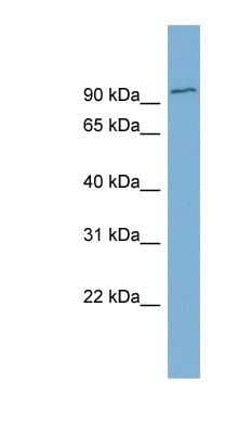 Western Blot: FBXO34 Antibody [NBP1-56540]
