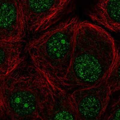 Immunocytochemistry/ Immunofluorescence: FBXO36 Antibody [NBP2-56087]