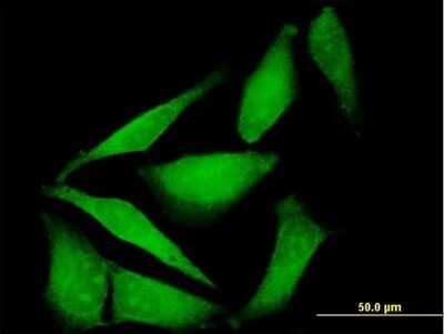 Immunocytochemistry/ Immunofluorescence: FBXO40 Antibody [H00051725-B01P]