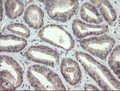 Immunohistochemistry: FBXO42 Antibody (OTI1H4) [NBP2-45621]