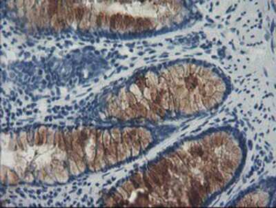Immunohistochemistry-Paraffin: FBXO42 Antibody (OTI2G7) [NBP2-03909]