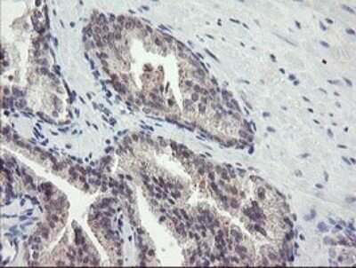 Immunohistochemistry: FBXO42 Antibody (OTI1H4) - Azide and BSA Free [NBP2-71960]