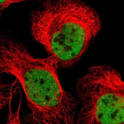 Immunocytochemistry/ Immunofluorescence: FBXO44 Antibody [NBP1-84728]