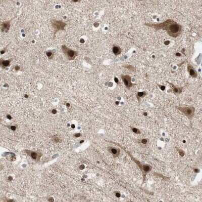 Immunohistochemistry-Paraffin: FBXO44 Antibody [NBP1-84728]
