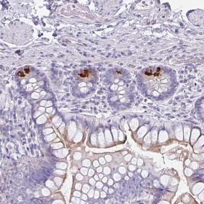 Immunohistochemistry: FBXO47 Antibody [NBP2-31679]