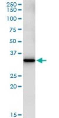 Immunoprecipitation: FBXO6 Antibody (3F10) [H00026270-M01]