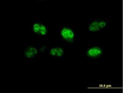 Immunocytochemistry/ Immunofluorescence: FBXO7 Antibody [H00025793-B01P]