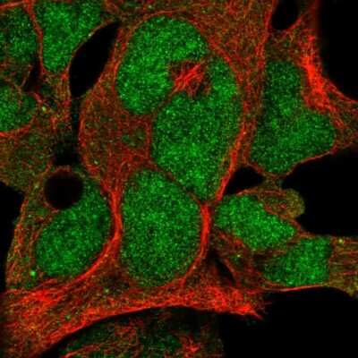 Immunocytochemistry/ Immunofluorescence: FBXO7 Antibody [NBP2-58563]
