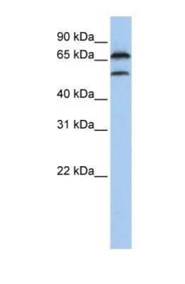 Western Blot: FBXO7 Antibody [NBP1-55051]