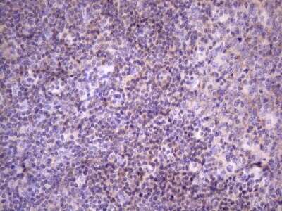 Immunohistochemistry: FBXO8 Antibody (OTI3C5) [NBP2-45622]
