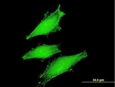 Immunocytochemistry/ Immunofluorescence: FBXW11 Antibody (2E7) [H00023291-M03]