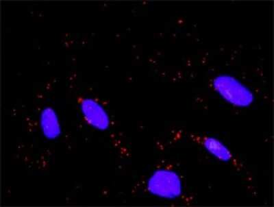 Proximity Ligation Assay: FBXW11 Antibody (2E7) [H00023291-M03]